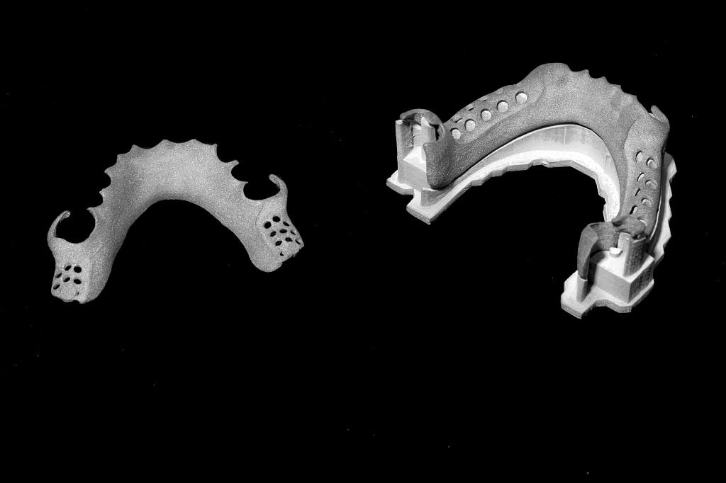 3D printen van metalen voor orthopedische implantaten